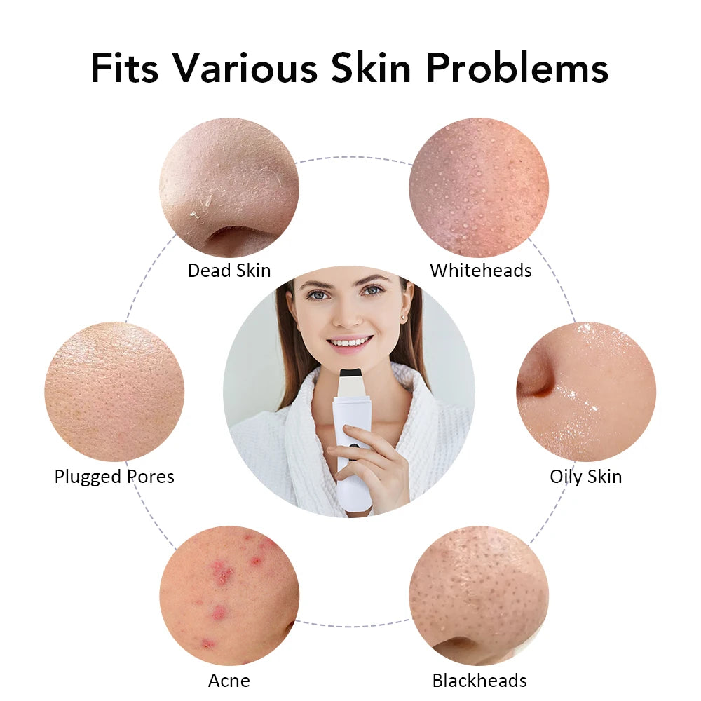 Ultrasonic Skin Scrubber